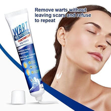 Atemporal Warts Remover Cream
