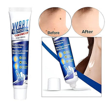 Atemporal Warts Remover Cream