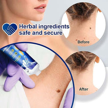 Atemporal Warts Remover Cream